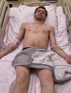 Pomóżmy Dawidowi w walce o życie! Potrzebna pilna transplantacja