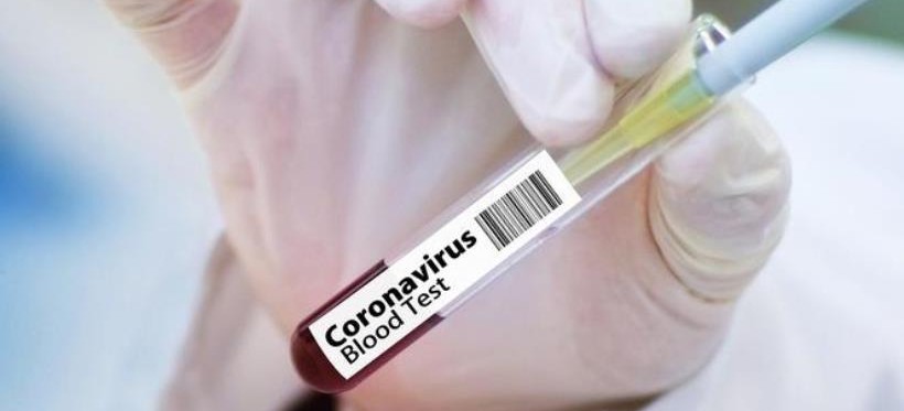 KORONAWIRUS. 13 nowych zarażeń, jeden zgon, 4 wyzdrowienia!