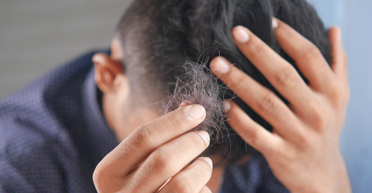 Przyczyny i sposoby leczenia przerzedzających się włosów